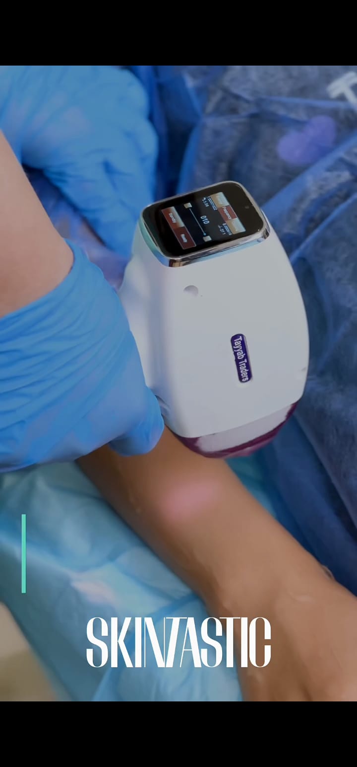 Arms and Legs Laser Hair Removal at SkinTastic Sargodha