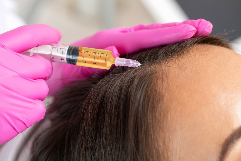 Exosome Stem Cells Therapy Hair Loss treatment at SkinTastic Sargodha