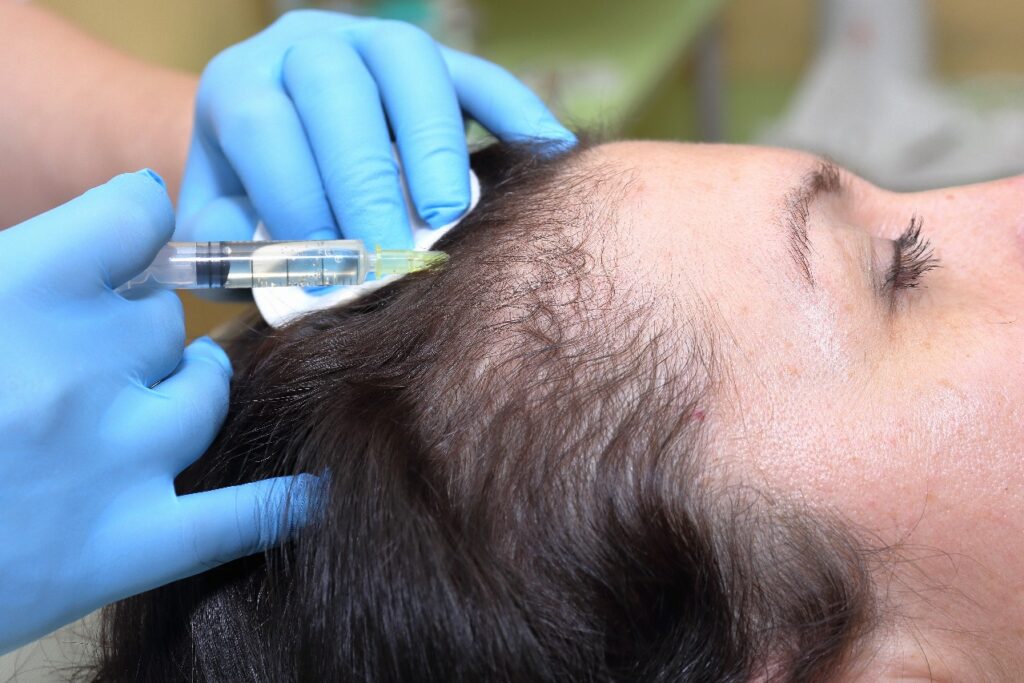 Exosome Stem Cells Therapy Hair Loss at Skintastic Aesthetic Clinic Sargodha