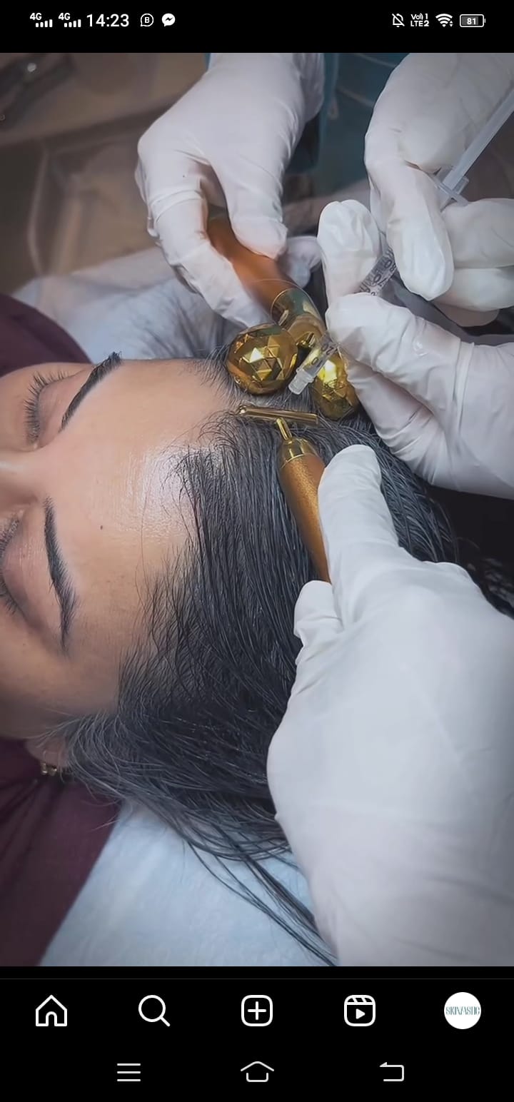 Exosome Stem Cells Therapy Hair Loss treatment at SkinTastic Sargodha