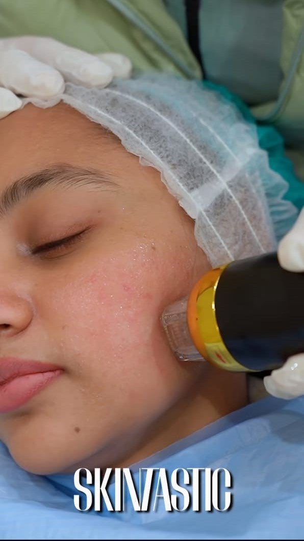 Pulpectomy Pulpotomy at Skintastic Aesthetic Clinic Sargodha