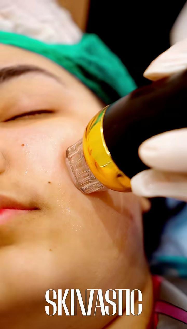 Pulpectomy Pulpotomy treatment at SkinTastic Sargodha