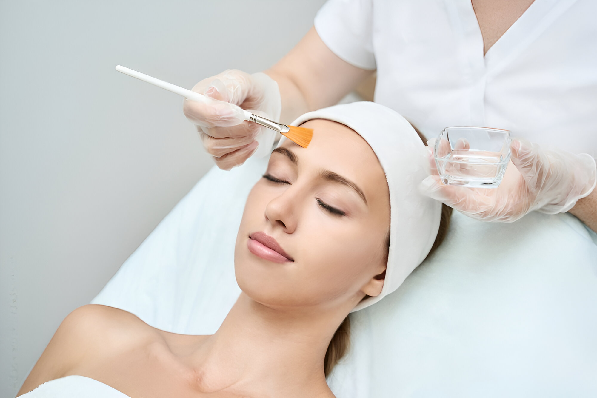 Chemical Peel treatment at Skintastic Sargodha