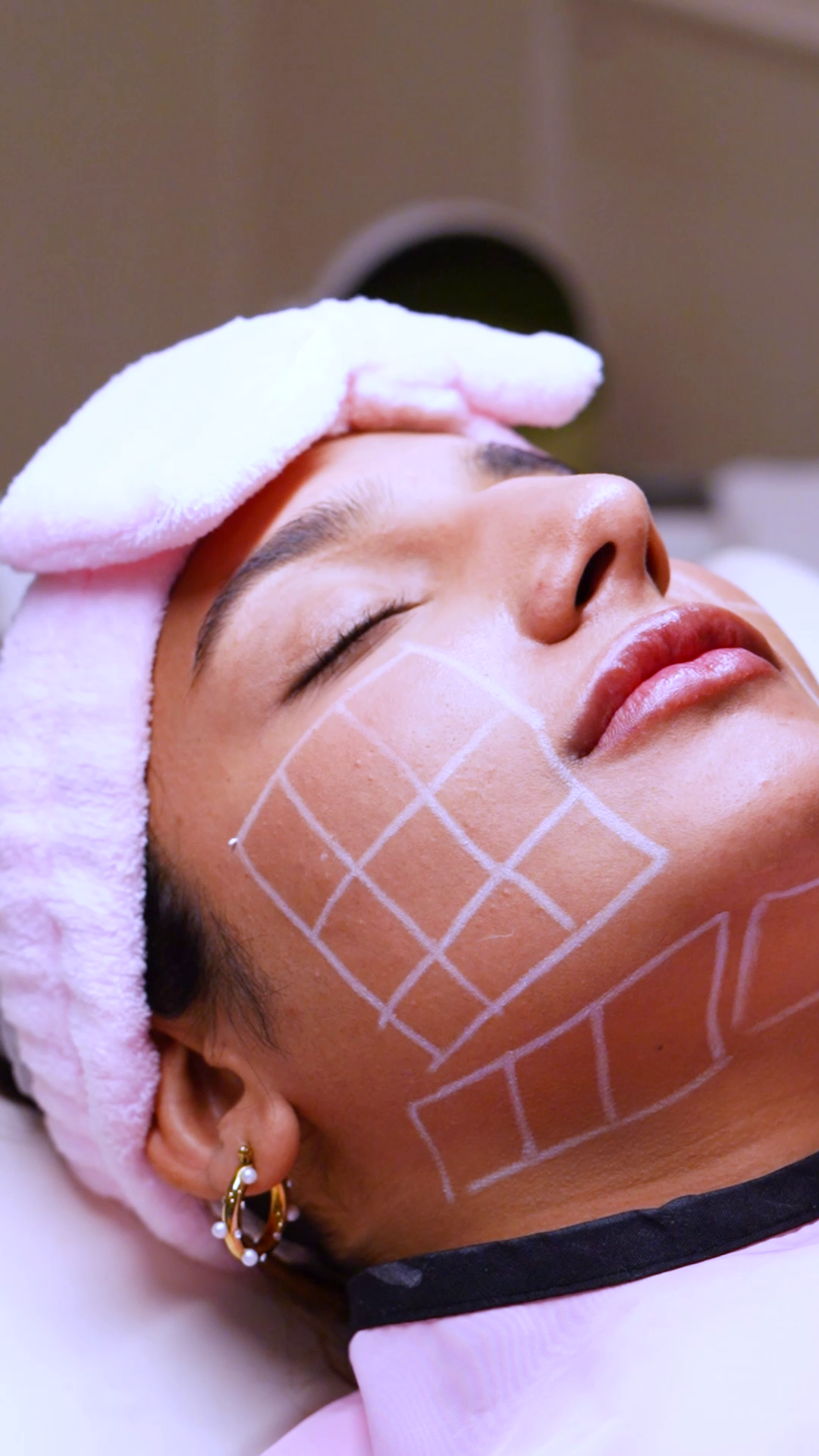 Immune Boosting treatment at SkinTastic Sargodha