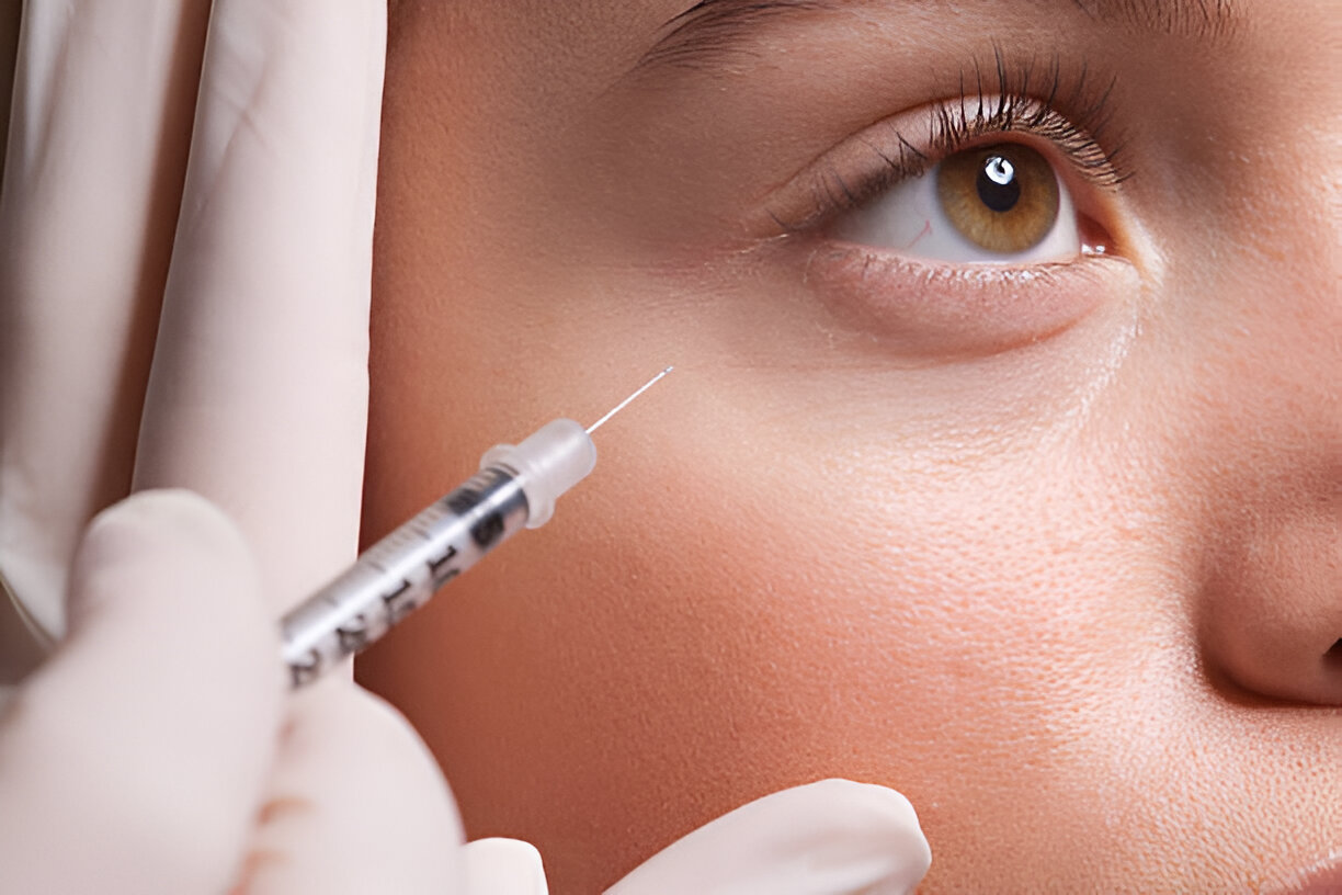 Undereye Treatment at Skintastic Aesthetic Clinic Sargodha