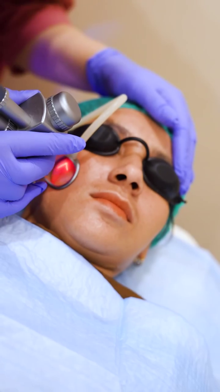 Stretch Mark Remodelling at Skintastic Aesthetic Clinic Sargodha
