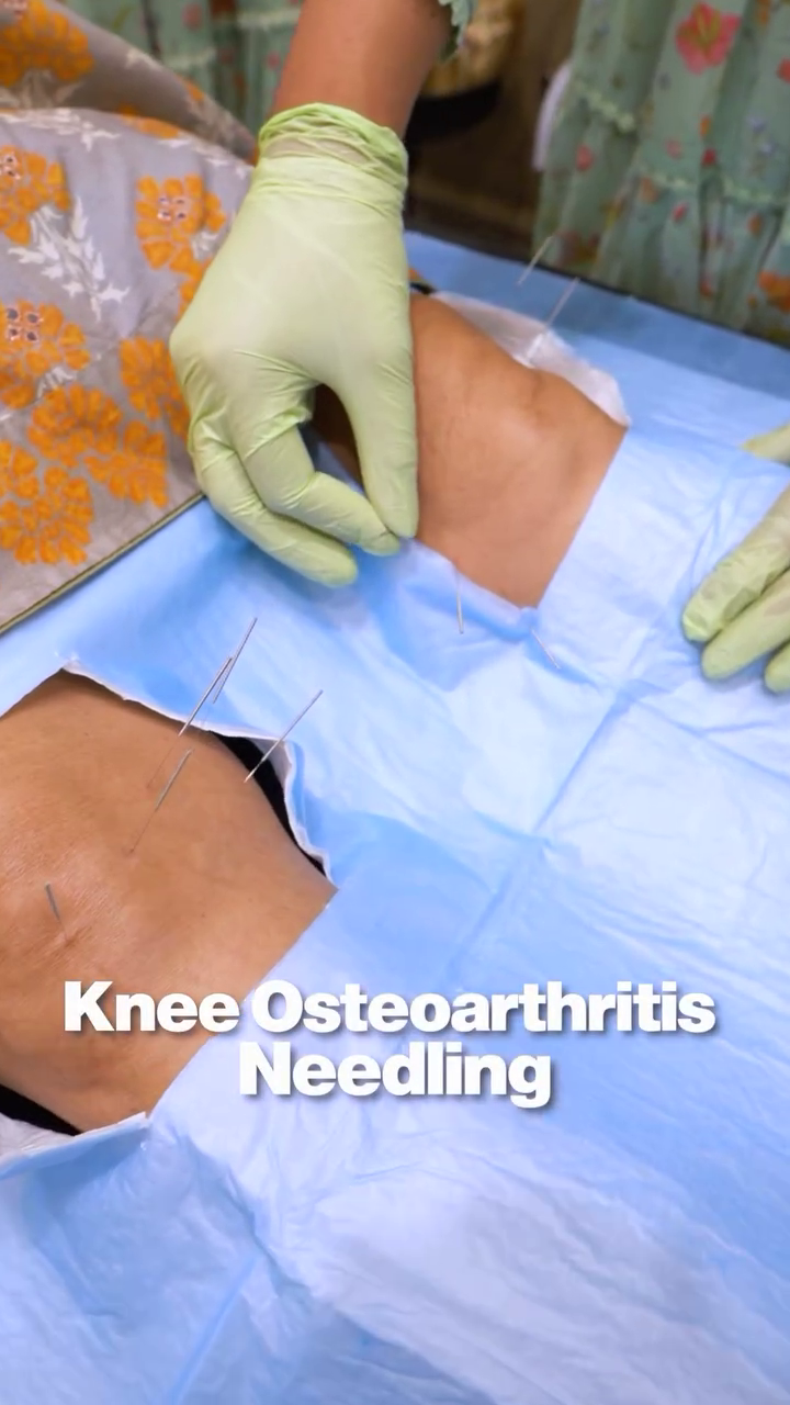 Knee Pain at Skintastic Aesthetic Clinic Sargodha