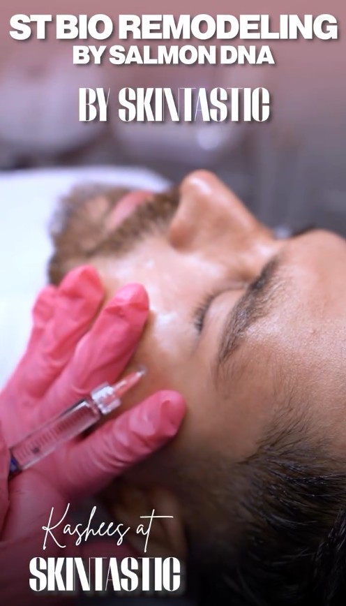 ST Bioremodeling at Skintastic Aesthetic Clinic Sargodha