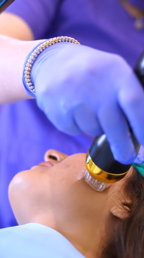 Acne Scar Removal View 1