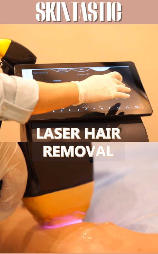 Bikini Area Laser Hair Removal at SkinTastic Sargodha