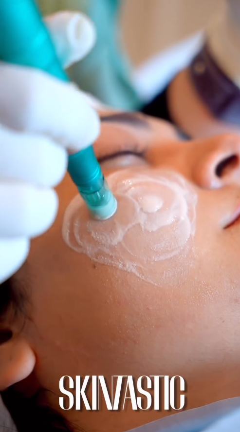 Microneedling With Stem Cells at Skintastic Aesthetic Clinic Sargodha