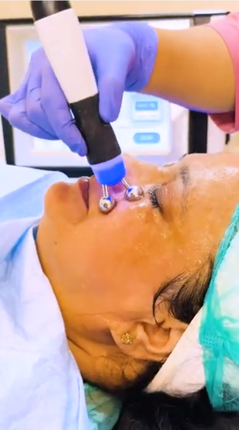 Moon Shine Hydra Facial treatment at SkinTastic Sargodha