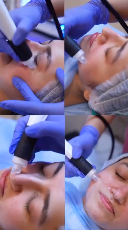 Hydra Glow Treatment at SkinTastic Sargodha