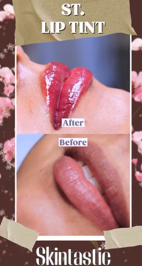 St Lip Tint at Skintastic Aesthetic Clinic Sargodha