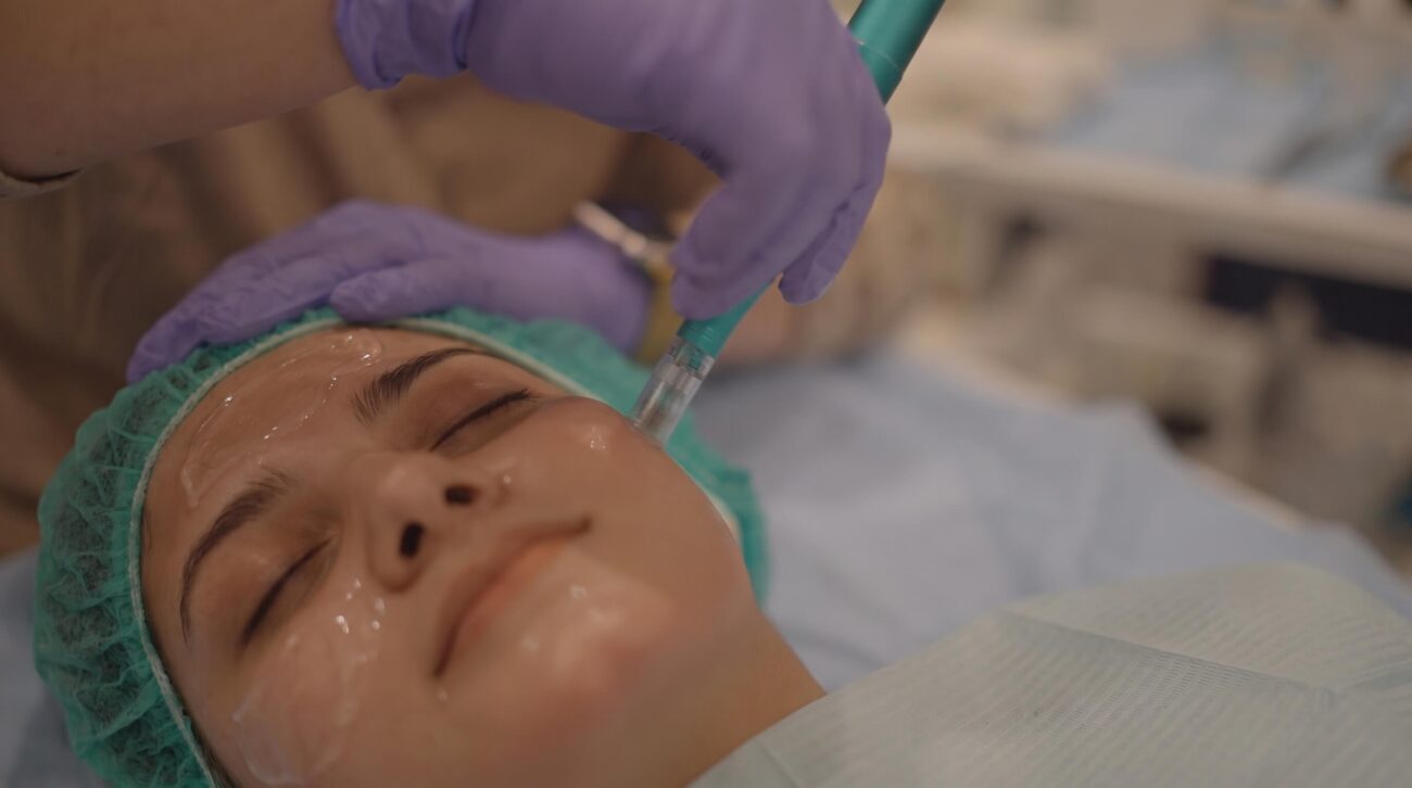 Microneedling Benefits, Results, and Essential Aftercare Tips