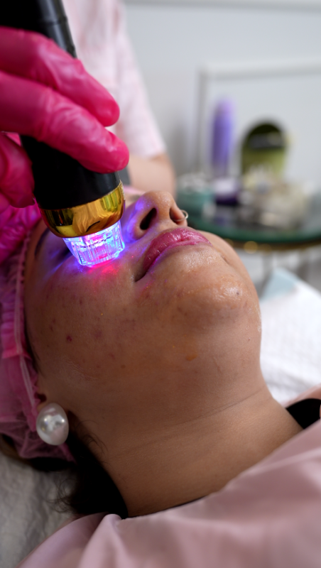 When to Start Skin Rejuvenation Age Guide & Signs